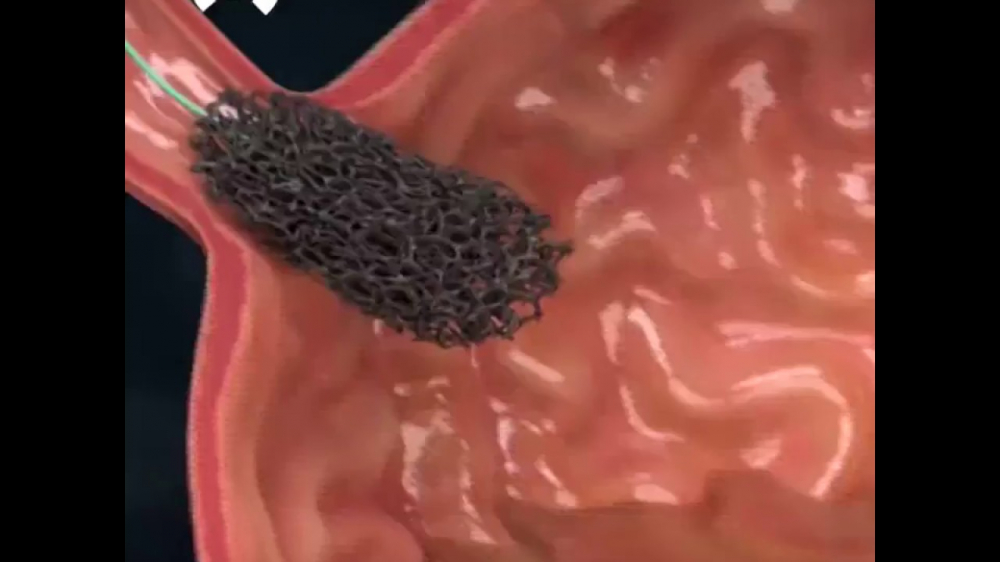 6 dấu hiệu nhận biết UNG THƯ VÒM HỌNG sớm nhất ai cũng nên biết, đừng để quá muộn