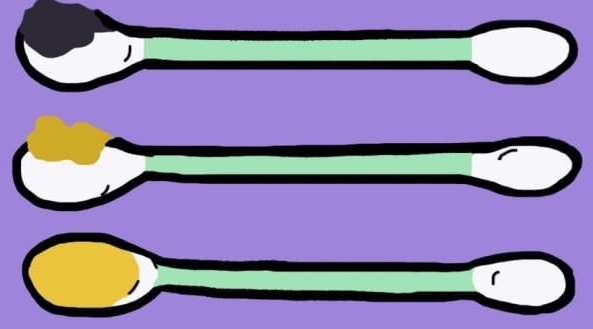 Màu sắc ráy tai nói gì về tình trạng sức khỏe hiện tại của bạn?