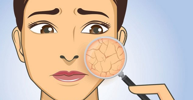 Hết lo da "khóc thét" vì khô nẻ mùa lạnh chỉ với 6 cách này