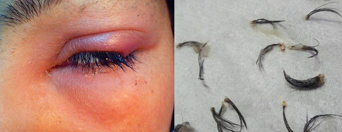 Ôm hận vì nối mi để đi chơi Noel nhiều chị em khóc thét khi “Làm mi giả, rụng sạch cả mi thật”