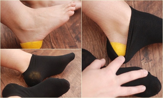 Gót chân bị cước, nứt nẻ cứ lấy vỏ chanh úp vào gót rồi xỏ tất 30 phút là khỏi ngay sau 1 đêm