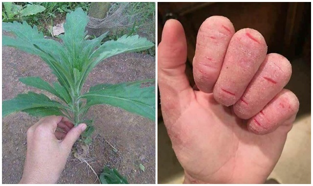 Ai nấm chân nấm tay, da nẻ toác mùa đông chỉ cần ngâm nước này trong 30 phút là khỏi hoàn toàn - Em đã làm và không tái phát từ năm 2014 đấy
