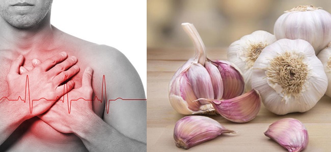 Bác sĩ bất ngờ chỉ 1 củ tỏi có thể tiêu diệt 14 loại ung thư và 13 loại vi rút