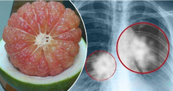 Cách lọc sạch phổi chỉ trong 3 ngày dù người đó có ‘thâm niên’ hút thuốc 40 năm