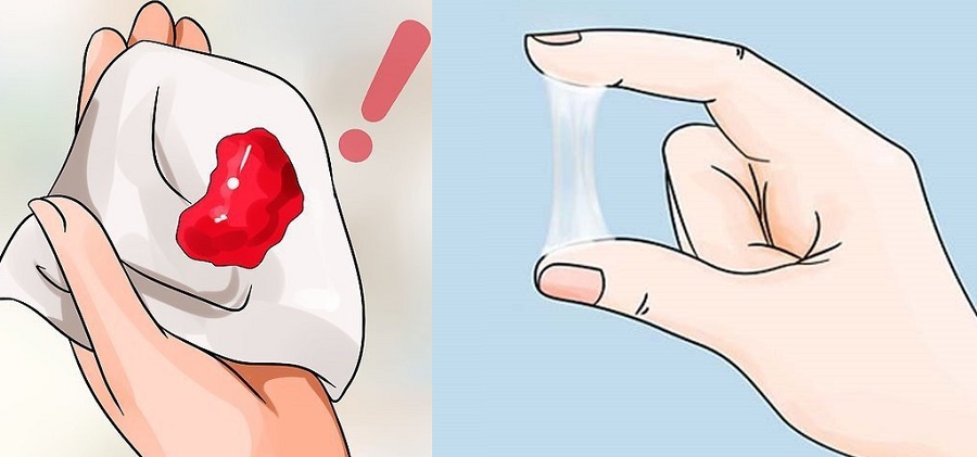 Dấu hiệu cảnh báo bạn có nguy cơ mắc ung thư nội mạc t.ử cu.ng