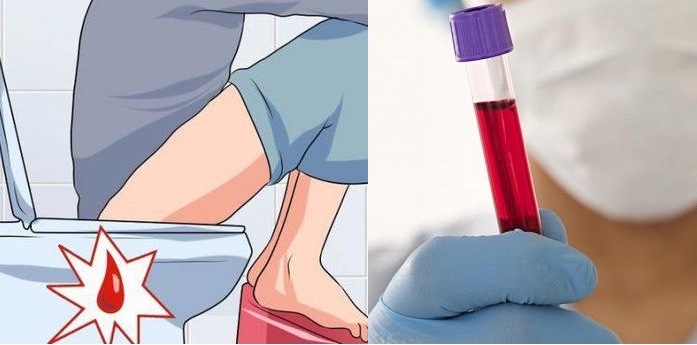 Chảy máu bất thường ở 7 vị trí này trên cơ thể – nguy cơ mắc trọng bệnh cần hết sức cảnh giác