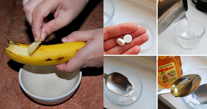 Chị em nào mụn nổi khắp mặt, trị mãi không khỏi, chuẩn bị 1quả chuối + 1 viên Aspirin rồi làm theo cách này là da đẹp lên 100&permil;