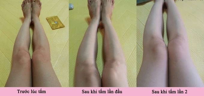 Da không những trắng hồng mà sẹo thâm, nám cũng sạch bong một đi không trở lại với nguyên liệu chưa tới 10 ngàn đồng