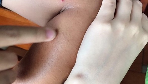 Từ hôm nay trở đi chị em sẽ không đi Spa ẩm nữa, da sẽ trắng như bông bưởi chỉ nhờ thoa hỗn hợp này qua đêm