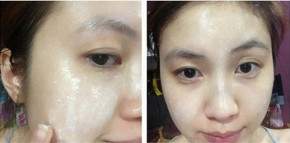 “Nằm lòng” 5 cách “hồi sinh” làn da sạm đen, thâm nám, lão hóa, khô ráp từ 1 thìa bột sắn dây này bạn nhé