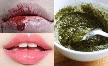 Môi khô, nứt nẻ đến chảy máu chỉ cần áp dụng ngay công thức này đảm bảo môi căng hồng, mướt mịn
