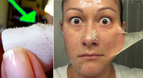 Tự làm mặt nạ trị mụn chỉ trong 15 phút ngắn ngủi đã khiến khuôn mặt thay đổi một cách đáng kể!