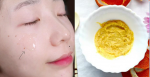 Đắp hỗn hợp này lên mặt chỉ sau một đêm, làn da đen nhẻm, sạm màu cũng bật tông trắng mịn ngỡ ngàng