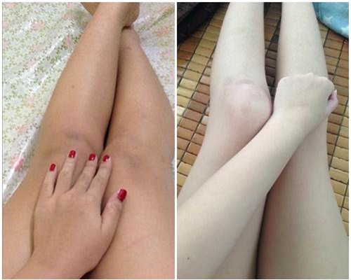 Lịch trình "THAY ĐỔI LÀN DA TRẮNG SÁNG" chỉ sau 7 ngày đơn giản ngay tại nhà