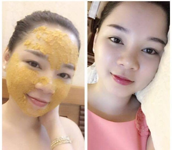 5 Mặt nạ thiên nhiên giúp bạn chăm sóc làn da hỗn hợp “khó chiều” cực đơn giản