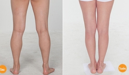 Massage 2 phút/ngày theo cách này, bắp chân, tay to như cột đình cũng sẽ thon gọn đẹp như người mẫu