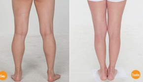 Massage 2 phút/ngày theo cách này, bắp chân, tay to như cột đình cũng sẽ thon gọn đẹp như người mẫu