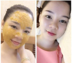 5 Mặt nạ thiên nhiên giúp bạn chăm sóc làn da hỗn hợp “khó chiều” cực đơn giản