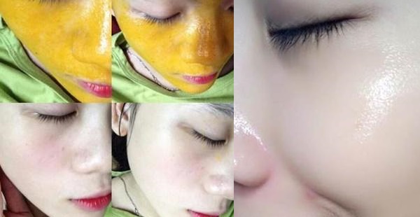 Đánh bay đám mụn thâm cứng đầu, da dẻ trở nên hồng hào căng mịn mà không hề tốn kém