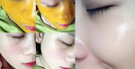 Đánh bay đám mụn thâm cứng đầu, da dẻ trở nên hồng hào căng mịn mà không hề tốn kém