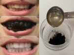 Mẹo tẩy trắng răng bằng than hoạt tính hiệu quả, an toàn để đón Tết