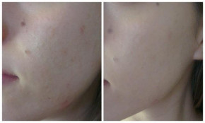 Dẹp hết tự ti về nhan sắc đi, mình dùng cách này để bây giờ có thể để mặt mộc ra đường