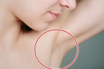 Làm ngay cách này để nách thâm đen trở nên trắng mịn sau một đêm