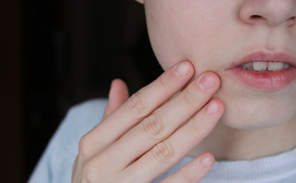 Lột sạch mụn đầu đen với mặt nạ trà túi lọc tự làm cực dễ