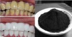 Răng trắng bóc, mảng bám bong tróc, mờ xỉn vàng chỉ nhờ nhúm than củi đen rẻ tiền