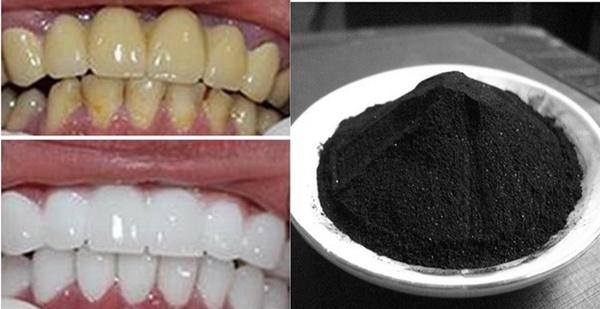 Răng trắng bóc, mảng bám bong tróc, mờ xỉn vàng chỉ nhờ nhúm than củi đen rẻ tiền