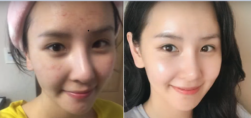 Học phụ nữ Hàn pha toner với nước để rửa mặt theo cách này, cả đời không lo mụn nhọt, da căng mướt chỉ sau 2 tuần