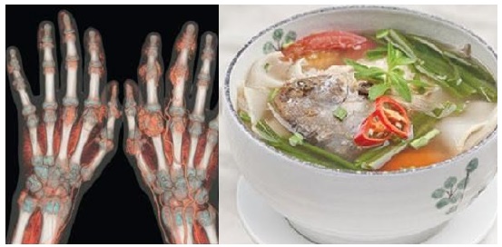 Đau nhức xương khớp đi không nổi cũng khỏi nhờ bài thuốc từ chuyên gia Đông y