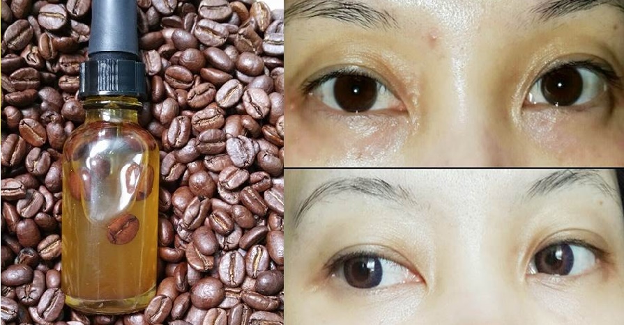 Mắt bọng thâm như gấu trúc cũng căng mịn sau 7 đêm sử dụng serum dưỡng mắt tự làm