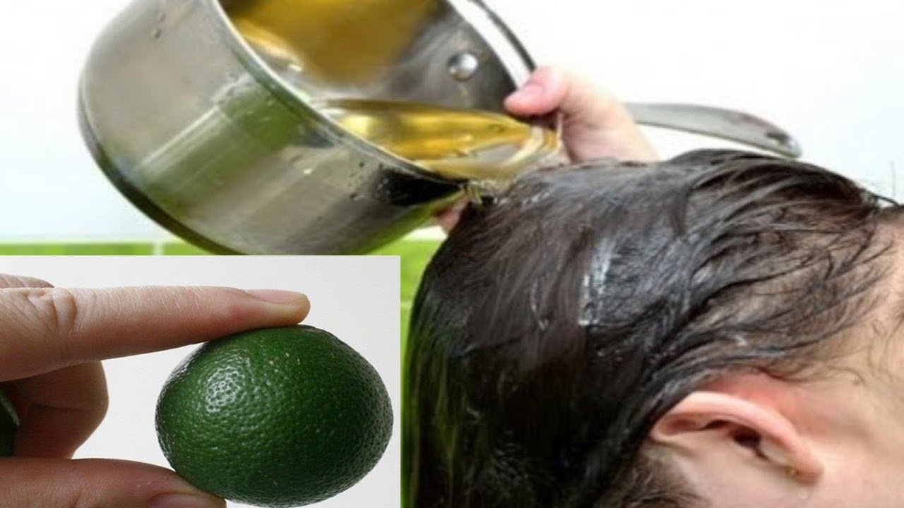 4 Bí kíp trị ”SẠCH” gàu hiệu quả chỉ với  1 quả chanh