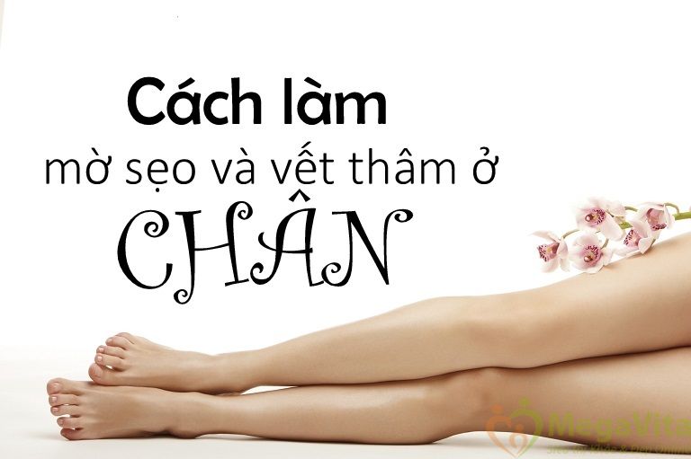“Gom nhặt” 5 bí quyết trị sẹo thâm ở chân lâu năm bằng thiên nhiên nhanh nhất
