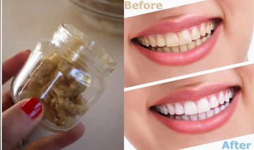 Ngậm 1 thìa hỗn hợp này răng sẽ trắng sáng như bọc sứ trị dứt điểm hôi miệng mà chẳng tốn 1 xu đi nha sĩ