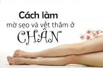 “Gom nhặt” 5 bí quyết trị sẹo thâm ở chân lâu năm bằng thiên nhiên nhanh nhất
