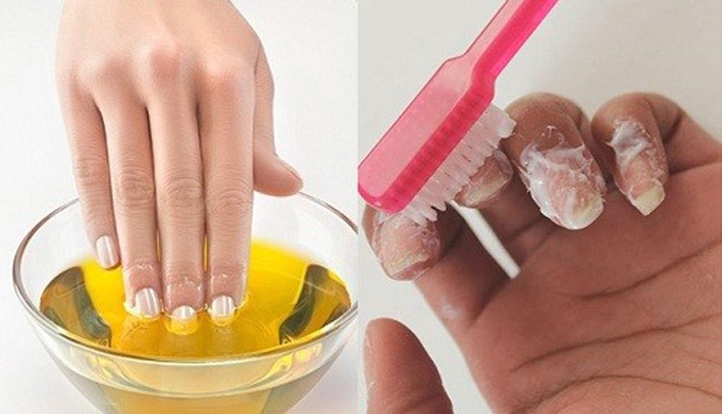 4 Mẹo khắc phục móng tay ố vàng do lạm dụng sơn móng nhanh chóng, hiệu quả