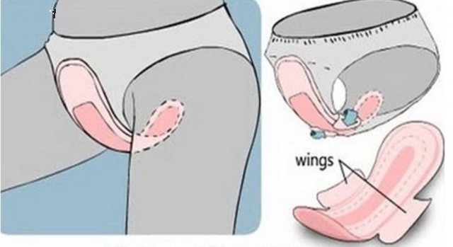 Nếu cứ giữ thói quen dùng băng VS theo kiểu này thì bảo sao chị em lại mắc bệnh vùng kín