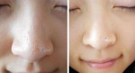 Thu nhỏ lỗ chân lông mãi mãi bằng những nguyên liệu nhà nào cũng có, chỉ sau vài ngày da mướt mịn căng bóng không ngờ!