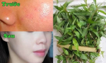 Giã nát rau răm đem trộn thứ này thoa lên, lỗ chân lông to như hố cũng se khít tức thì, da mịn màng, không mụn nhọt!