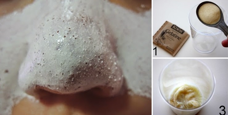 Đã tìm ra công thức làm 1 lần lột cả trăm nhân mụn mà không cần nặn