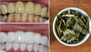 Răng trắng bóc trong vòng 1 tháng chỉ nhờ nắm lá dễ kiếm này
