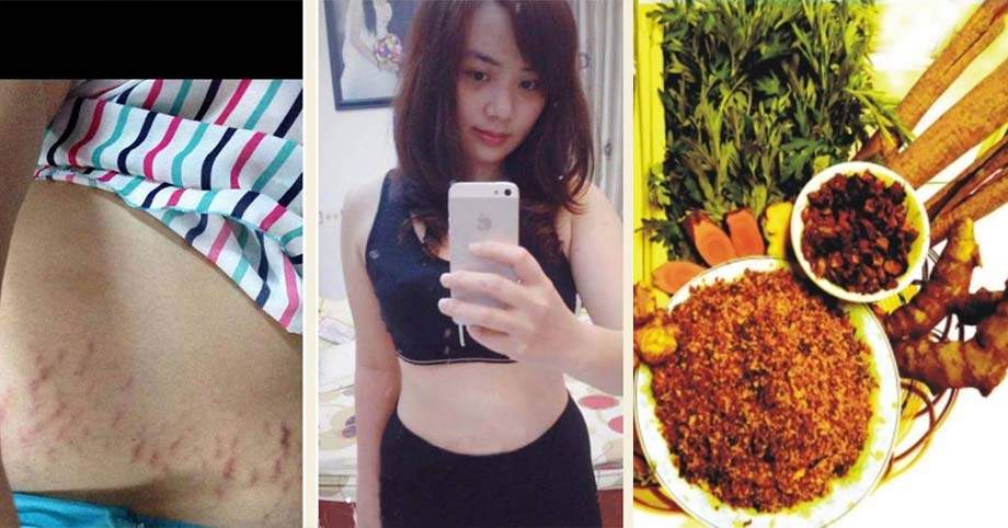 Tuyệt chiêu làm đẹp sau sinh “từ đầu đến chân”: Trắng da, ngăn rụng tóc, thu nhỏ vùng kín, eo thon, cơ thể thơm tho