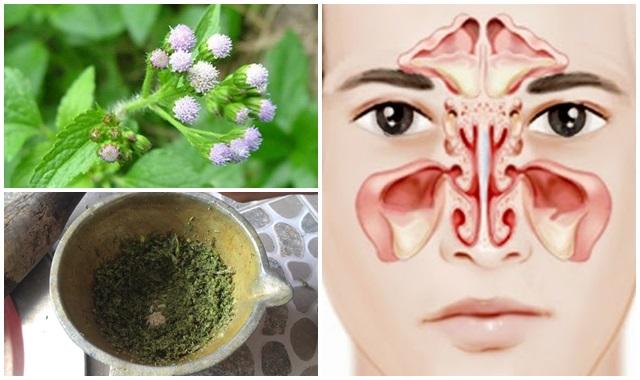 Độc chiêu chữa khỏi dứt điểm VIÊM XOANG mãn tính bằng HOA CỨT LỢN, 100&permil; thành công với bất kì cơ địa nào nhé!