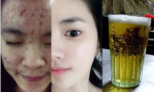 Rửa mặt với bia của bố ngày Tết và cô gái nhận được cái kết bất ngờ