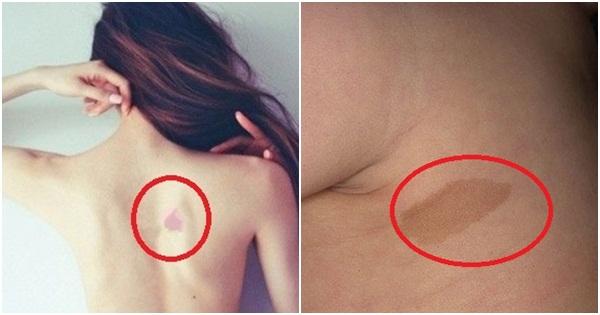 Phụ nữ có vết bớt ở 7 vị trí này cả đời giàu sang, an nhàn hạnh phúc, phúc tu 3 đời mới có được