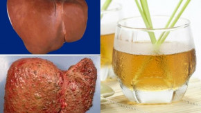 Thải độc gan, thận, bàng quang và cả tuyến tụy chỉ với 1 ly nước sả vô cùng đơn giản