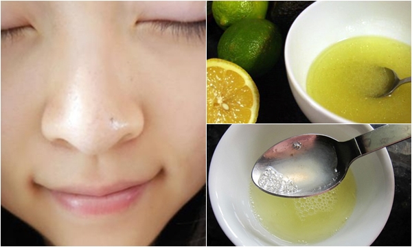 2 Bí quyết lợi hại giúp XÓA SỔ mụn đầu đen và gairi quyết vấn đề DA DẦU