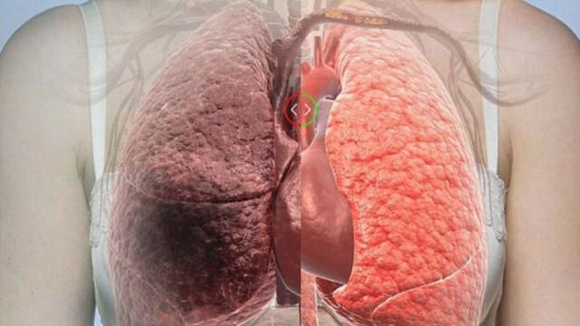 Ăn nhiều muối chính là sát thủ gây ra 4 chứng ung thư hàng loạt người mắc phải nhất nước ta